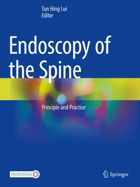 Lui | Endoscopy of the Spine | Buch | 978-981-19-7763-3 | www.sack.de