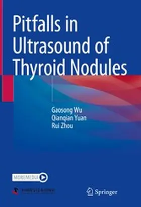 Wu / Yuan / Zhou |  Pitfalls in Ultrasound of Thyroid Nodules | eBook | Sack Fachmedien