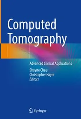 Chau / Hayre |  Computed Tomography | eBook | Sack Fachmedien