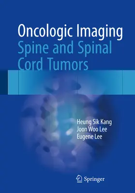 Kang / Lee | Oncologic Imaging: Spine and Spinal Cord Tumors | E-Book | www.sack.de