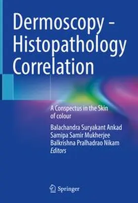 Ankad / Mukherjee / Nikam |  Dermoscopy - Histopathology Correlation | eBook | Sack Fachmedien