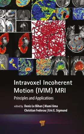 Le Bihan / Iima / Federau |  Intravoxel Incoherent Motion (IVIM) MRI | Buch |  Sack Fachmedien