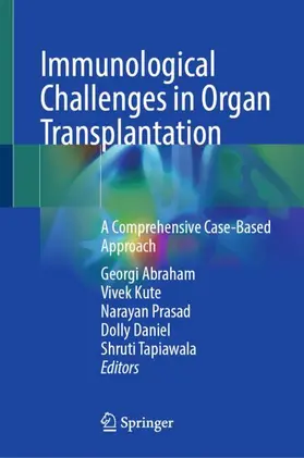 Abraham / Prasad / Kute |  Immunological Challenges in Organ Transplantation | Buch |  Sack Fachmedien