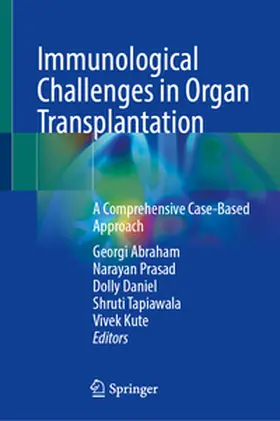 Abraham / Kute / Prasad |  Immunological Challenges in Organ Transplantation | eBook | Sack Fachmedien
