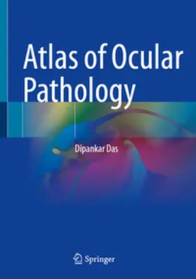 Das |  Atlas of Ocular Pathology | eBook | Sack Fachmedien