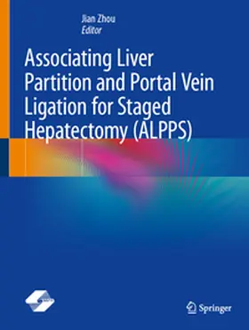 Zhou | Associating Liver Partition and Portal Vein Ligation for Staged Hepatectomy (ALPPS) | E-Book | www.sack.de