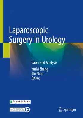 Zhang / Zhao |  Laparoscopic Surgery in Urology | Buch |  Sack Fachmedien