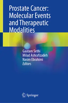 Sethi / Ashrafizadeh / Ebrahimi |  Prostate Cancer: Molecular Events and Therapeutic Modalities | eBook | Sack Fachmedien