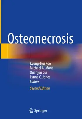 Koo / Jones / Mont |  Osteonecrosis | Buch |  Sack Fachmedien