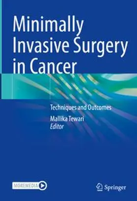 Tewari |  Minimally Invasive Surgery in Cancer | eBook | Sack Fachmedien