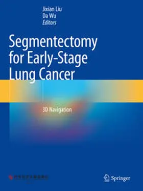 Wu / Liu |  Segmentectomy for Early-Stage Lung Cancer | Buch |  Sack Fachmedien