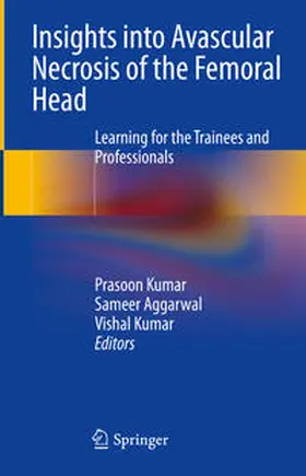 Kumar / Aggarwal |  Insights into Avascular Necrosis of the Femoral Head | eBook | Sack Fachmedien