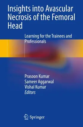 Kumar / Aggarwal |  Insights into Avascular Necrosis of the Femoral Head | Buch |  Sack Fachmedien