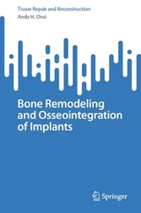Choi |  Bone Remodeling and Osseointegration of Implants | eBook | Sack Fachmedien