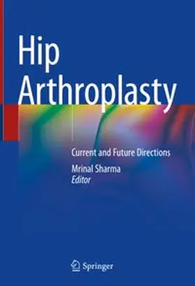 Sharma |  Hip Arthroplasty | eBook | Sack Fachmedien