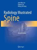 Lee / Kang |  Radiology Illustrated: Spine | Buch |  Sack Fachmedien