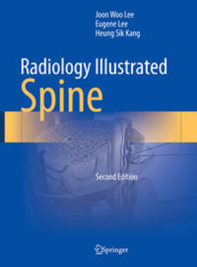 Lee / Kang | Radiology Illustrated: Spine | E-Book | sack.de