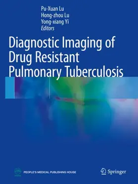 Lu / Yi |  Diagnostic Imaging of Drug Resistant Pulmonary Tuberculosis | Buch |  Sack Fachmedien