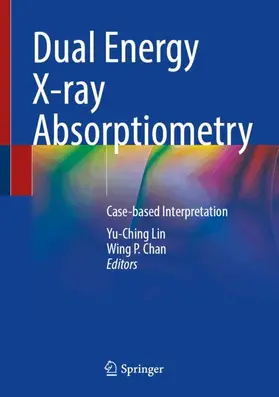 Lin / Chan |  Dual Energy X-ray Absorptiometry | Buch |  Sack Fachmedien