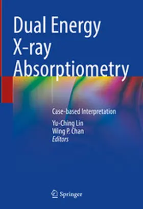 Lin / Chan |  Dual Energy X-ray Absorptiometry | eBook | Sack Fachmedien