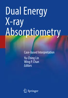 Lin / Chan |  Dual Energy X-ray Absorptiometry | Buch |  Sack Fachmedien