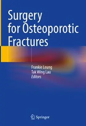 Leung / Lau |  Surgery for Osteoporotic Fractures | eBook | Sack Fachmedien