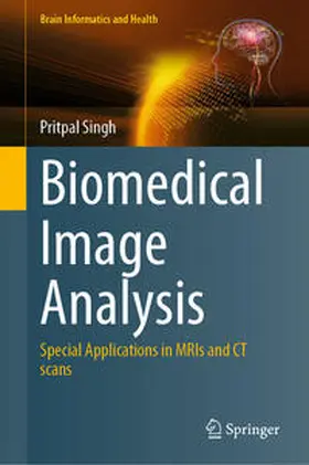Singh |  Biomedical Image Analysis | eBook | Sack Fachmedien
