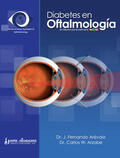Arevalo / Arzabe |  Diabetes en Oftalmología | Buch |  Sack Fachmedien