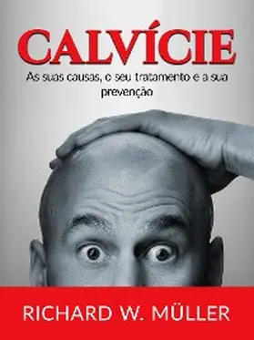 Müller |  Calvície (Traduzido) | eBook | Sack Fachmedien