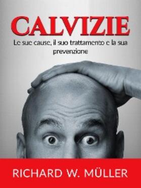 Muller |  Calvizie (Tradotto) | eBook | Sack Fachmedien