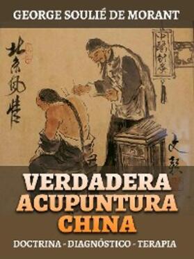 de Morant |  Verdadera Acupuntura China (Traducido) | eBook | Sack Fachmedien